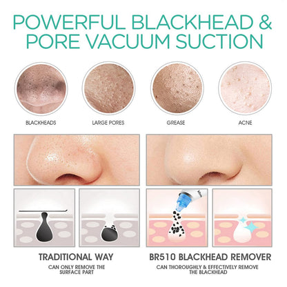 VOYOR Blackhead Remover Pore Vacuum - Black Head Remover for Face with LCD Screen, 5 Suction Levels and 6 Replaceable Heads, USB Rechargeable Face Vacuum Pore Cleaner for Women and Men (BR510)