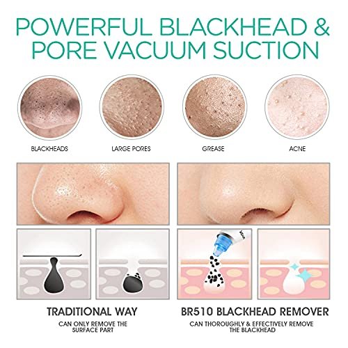 VOYOR Blackhead Remover Pore Vacuum - Black Head Remover for Face with LCD Screen, 5 Suction Levels and 6 Replaceable Heads, USB Rechargeable Face Vacuum Pore Cleaner for Women and Men (BR510) - görsel 6