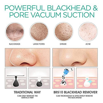 VOYOR Blackhead Remover Pore Vacuum - Black Head Remover for Face with LCD Screen, 5 Suction Levels and 6 Replaceable Heads, USB Rechargeable Face Vacuum Pore Cleaner for Women and Men (BR510)