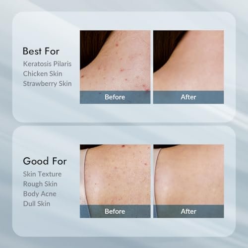 VILLAGE11FACTORY Relax Day AHA Exfoliating Body Lotion | Glycolic Acid Lotion for KP, Strawberry Legs & Rough Skin | Hydrating Body Moisturizer for Dark Spots, Acne & Texture | 10.6 fl oz Avelisse