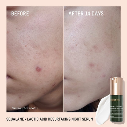Biossance Squalane + Lactic Acid Resurfacing Night Serum - Vegan 10% Lactic Acid Face Serum for Skin Texture and Fine Lines, Gentle Night Exfoliant, Hydrating Pore Reducer, 1 oz Avelisse