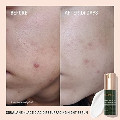 Biossance Squalane + Lactic Acid Resurfacing Night Serum - Vegan 10% Lactic Acid Face Serum for Skin Texture and Fine Lines, Gentle Night Exfoliant, Hydrating Pore Reducer, 1 oz Avelisse