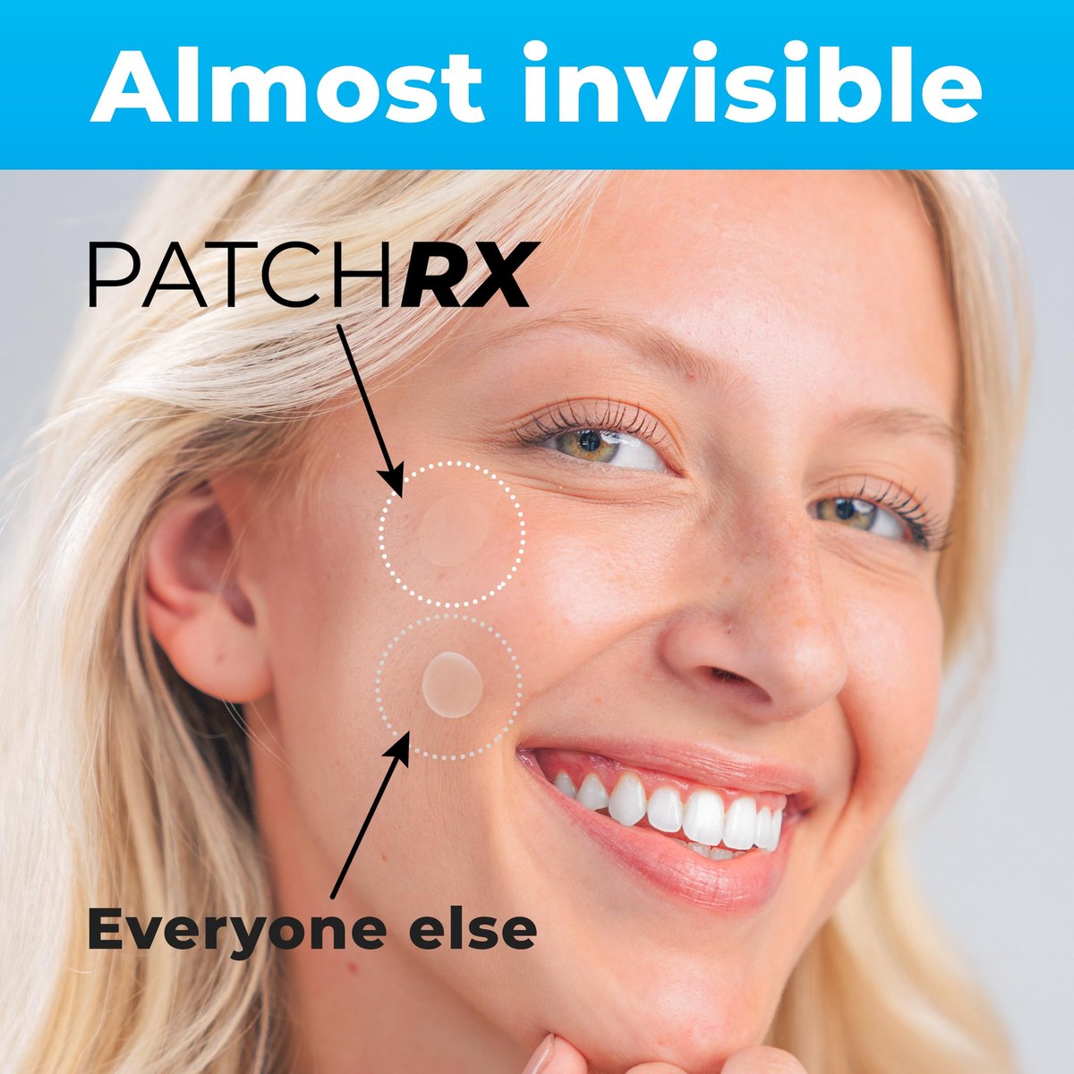 PatchRx Pimple Patches for Face (120 Patches) - Hydrocolloid Acne Patches with Tea Tree Oil, Acne Dots, Zit Stickers - görsel 5