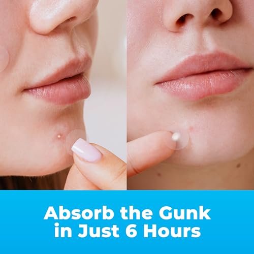 PatchRx Pimple Patches for Face (120 Patches) - Hydrocolloid Acne Patches with Tea Tree Oil, Acne Dots, Zit Stickers - görsel 4