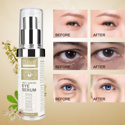 Anti Ageing Eye Cream - Anti Wrinkle Eye Serum for Puffy Eyes, Dark Circles, Eye Bags, Crows Feet, Wrinkles - ELBBUB