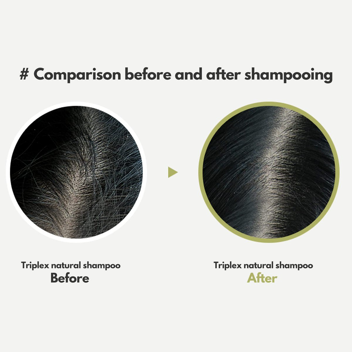 LA'DOR TripleX 3 Deep Cleansing Shampoo for Dry Itchy Sensitive Scalp & Dandruff - Sulfate-Free with Tea Tree, Lemon & Lavender - Korean Hair Care - 17.9 Fl Oz - görsel 10