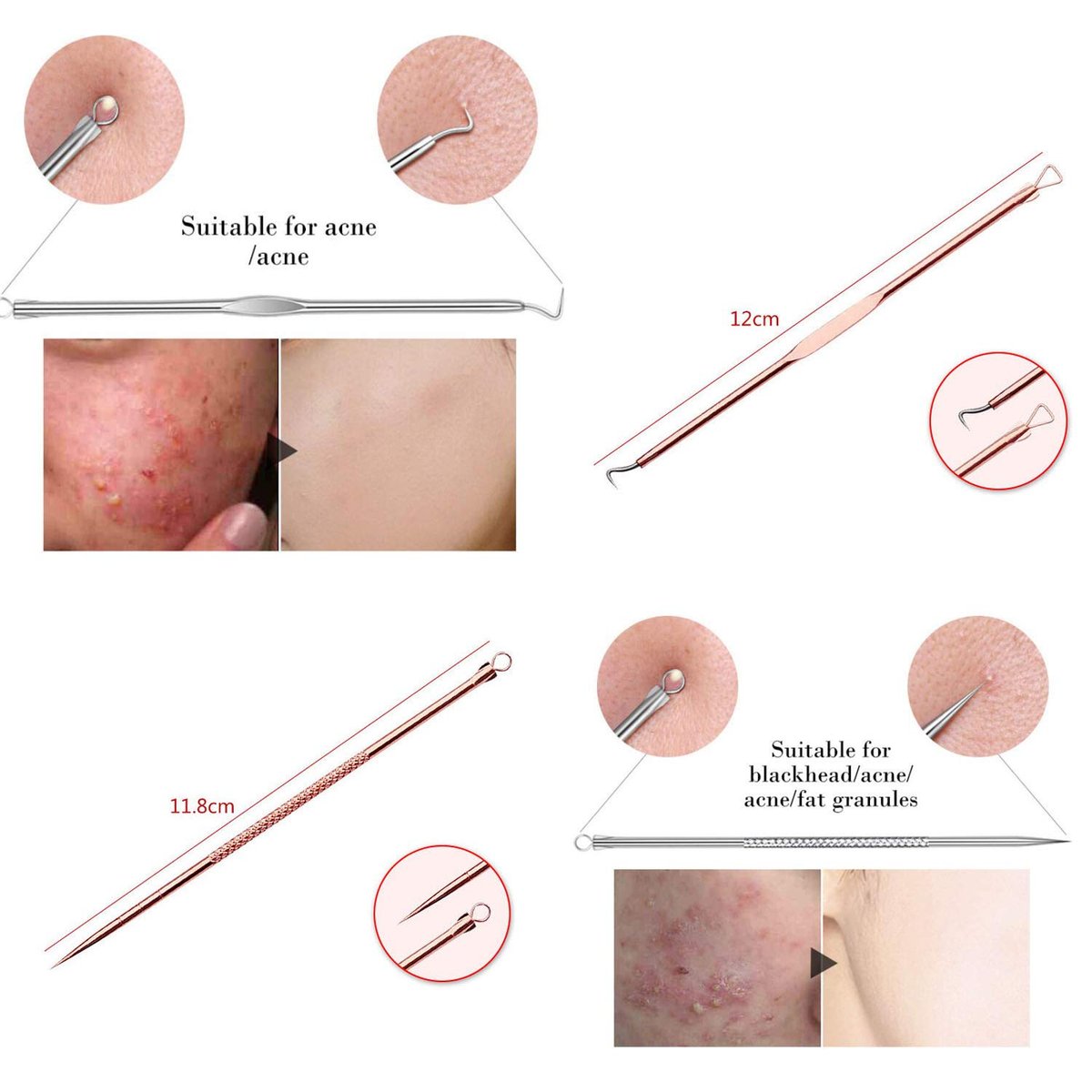 ZTRHYOO Blackhead Remover Tool Kit - Professional Acne Extraction Kit with Stainless Steel Pimple Comedone Extractor, Blemish Popping Tool for Face Nose (Rose, 4 Pieces) - görsel 9