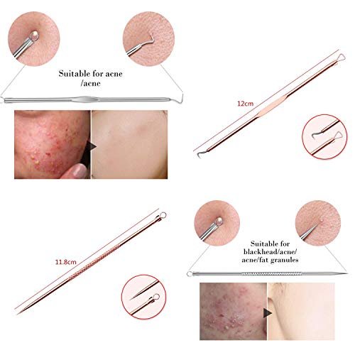 ZTRHYOO Blackhead Remover Tool Kit - Professional Acne Extraction Kit with Stainless Steel Pimple Comedone Extractor, Blemish Popping Tool for Face Nose (Rose, 4 Pieces) - görsel 10
