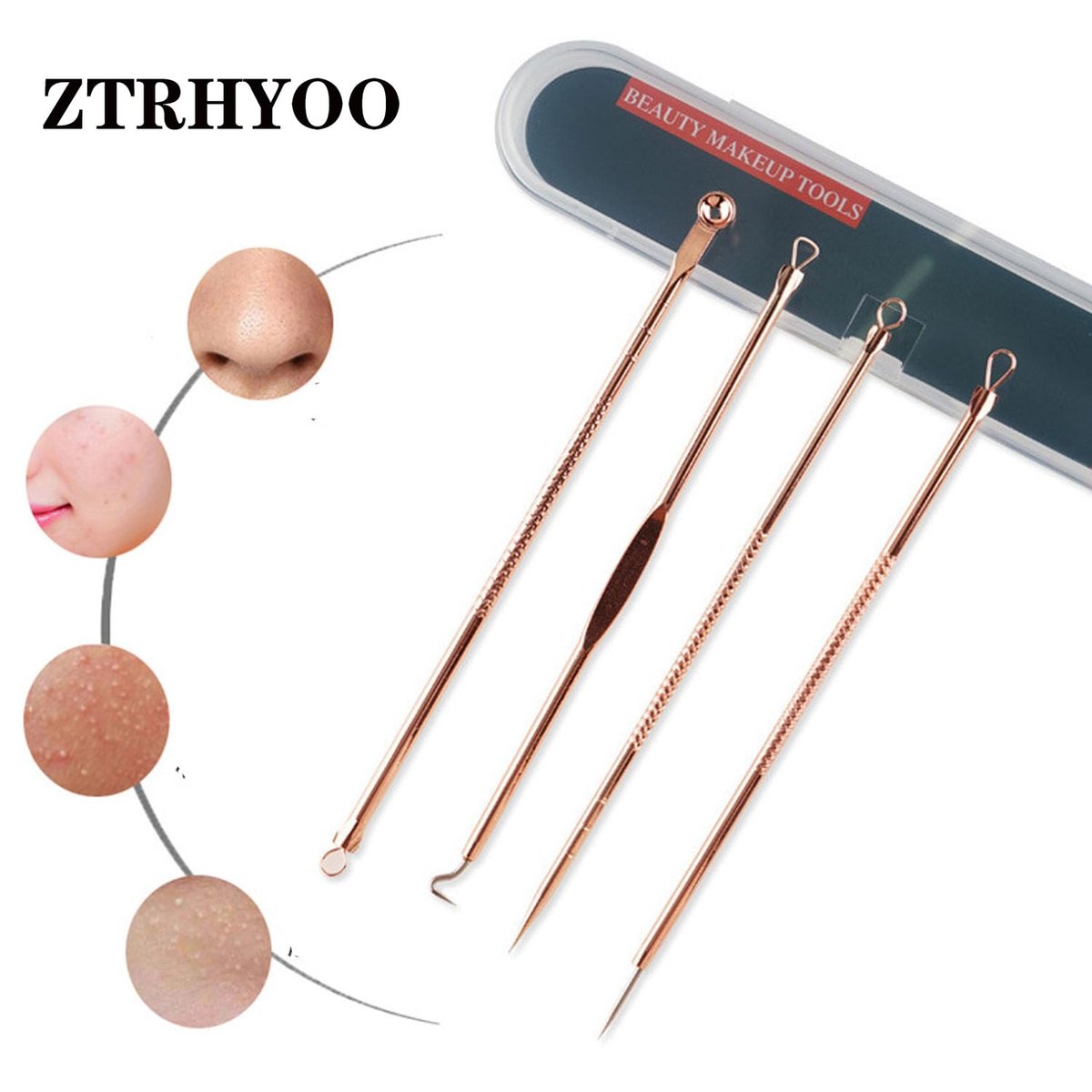 ZTRHYOO Blackhead Remover Tool Kit - Professional Acne Extraction Kit with Stainless Steel Pimple Comedone Extractor, Blemish Popping Tool for Face Nose (Rose, 4 Pieces) - görsel 5