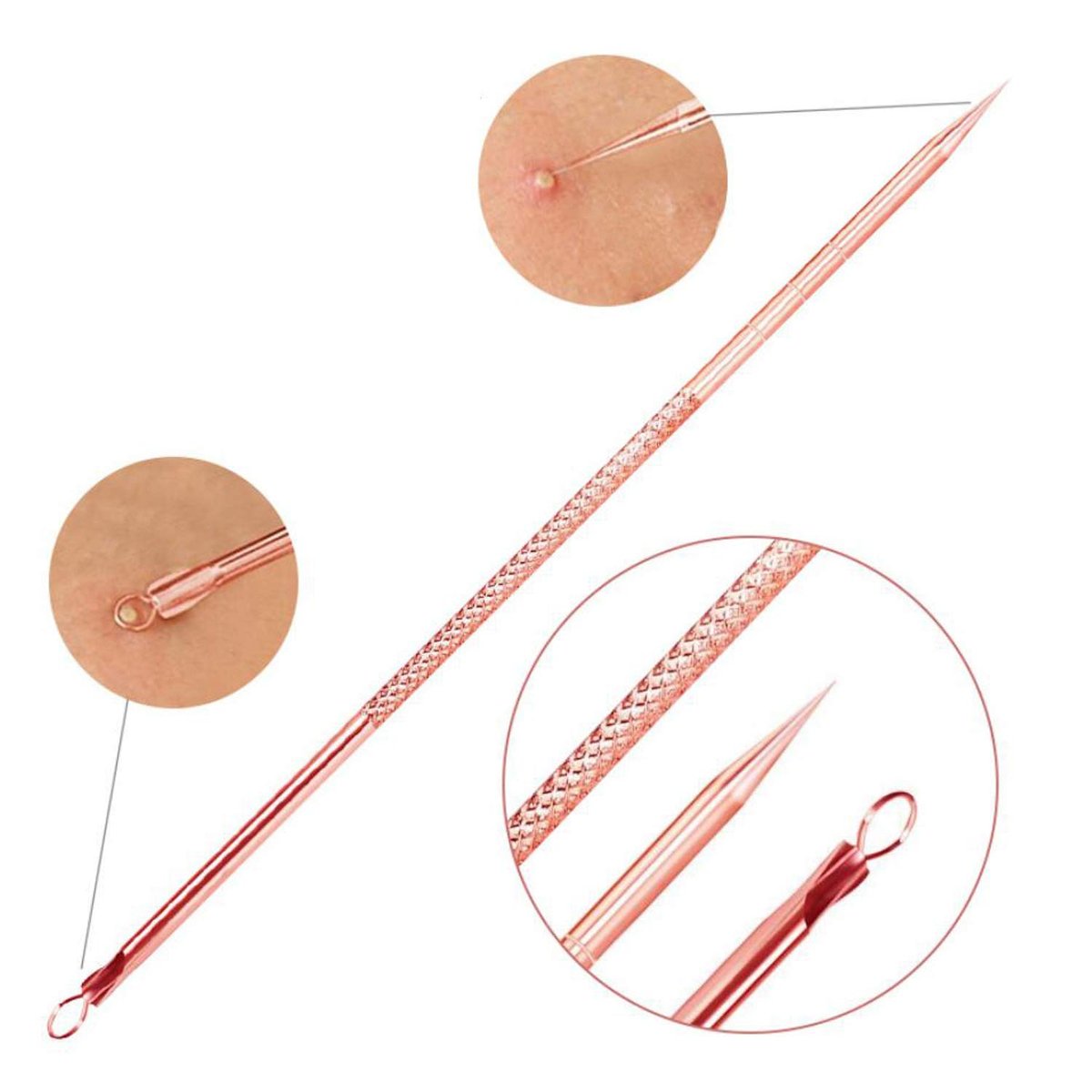 ZTRHYOO Blackhead Remover Tool Kit - Professional Acne Extraction Kit with Stainless Steel Pimple Comedone Extractor, Blemish Popping Tool for Face Nose (Rose, 4 Pieces) - görsel 11