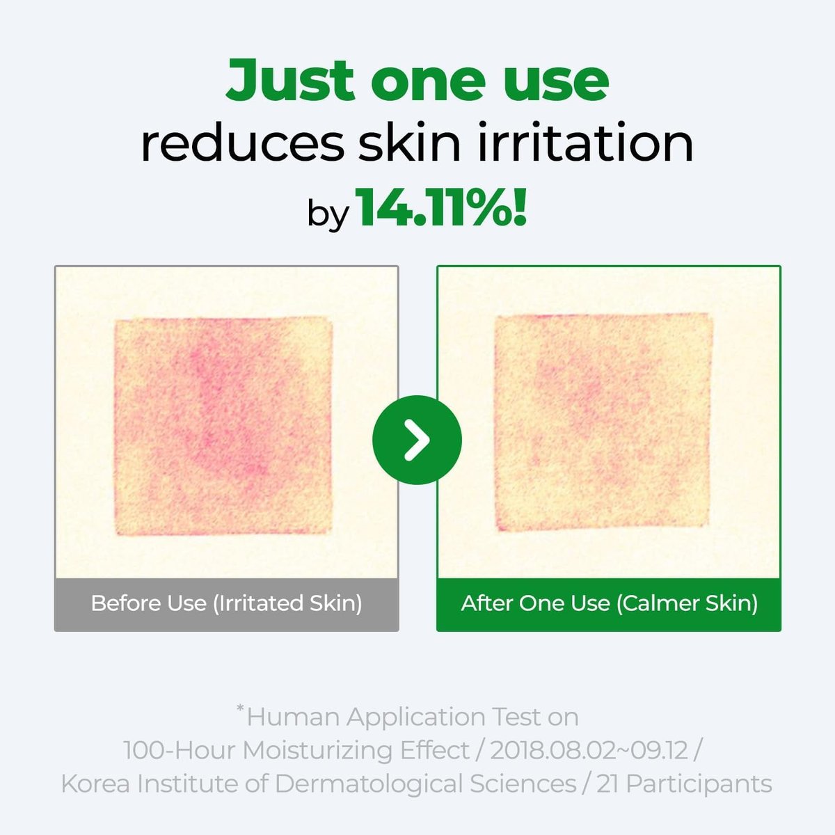 Cure Intensive 2X Cream - Premium Aloe Deep Moisturizing Multi Balm for Dry Skin | Korean Skincare (1.7 oz) Avelisse