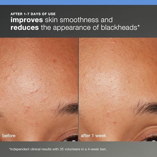 Dermalogica Discover Healthy Skin Kit – 4-Piece Starter Set for Glowing, Healthy Skin Avelisse