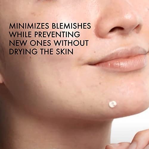 Vichy Normaderm S.O.S Acne Rescue Spot Corrector - 10% Sulfur, Niacinamide & Glycolic Acid Acne Spot Treatment for Sensitive Skin, 0.68 Fl Oz Avelisse