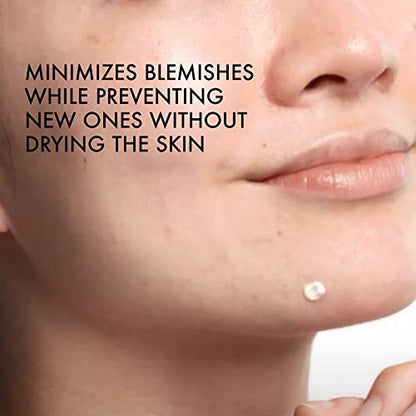 Vichy Normaderm S.O.S Acne Rescue Spot Corrector - 10% Sulfur, Niacinamide & Glycolic Acid Acne Spot Treatment for Sensitive Skin, 0.68 Fl Oz Avelisse