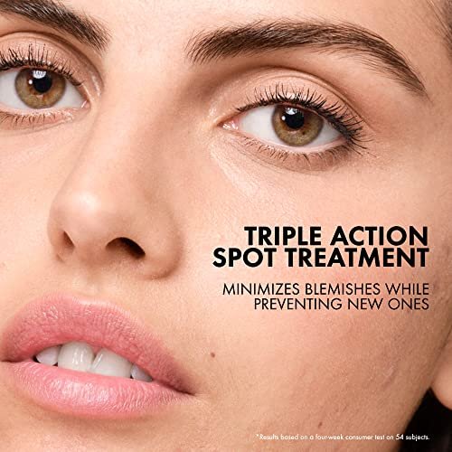 Vichy Normaderm S.O.S Acne Rescue Spot Corrector - 10% Sulfur, Niacinamide & Glycolic Acid Acne Spot Treatment for Sensitive Skin, 0.68 Fl Oz Avelisse