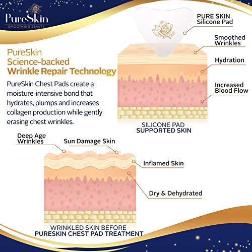 PureSkin Chest Wrinkle Pads (2-Pack) - Reusable Silicone Decollete Anti-Wrinkle Patches for Sleeping, Medical Grade Silicone Avelisse