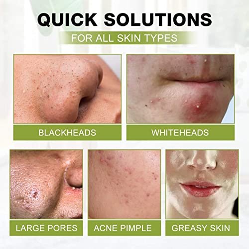 SHVYOG Blackhead Peel Off Face Mask with Brush & Tea Tree Oil Serum – 3-in-1 Charcoal Mask for Deep Cleansing, Pores & Oil Control (100g+30ml) - görsel 9