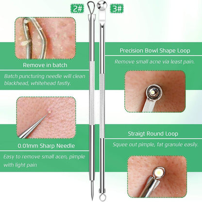 Professional Blackhead Remover Tool Kit - 5-Piece Stainless Steel Comedone Extractor Set for Acne, Pimple, and Blemish Removal