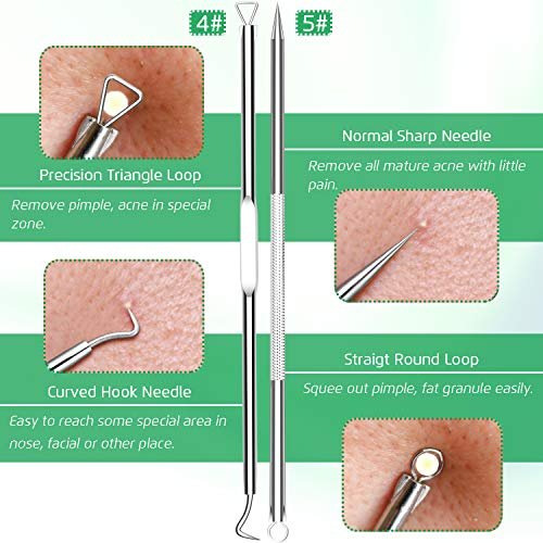 Professional Blackhead Remover Tool Kit - 5-Piece Stainless Steel Comedone Extractor Set for Acne, Pimple, and Blemish Removal - görsel 9
