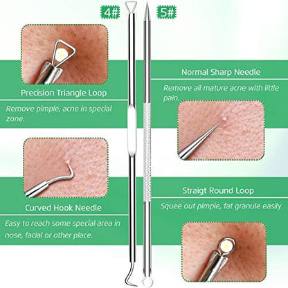Professional Blackhead Remover Tool Kit - 5-Piece Stainless Steel Comedone Extractor Set for Acne, Pimple, and Blemish Removal