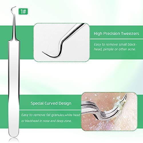 Professional Blackhead Remover Tool Kit - 5-Piece Stainless Steel Comedone Extractor Set for Acne, Pimple, and Blemish Removal - görsel 5