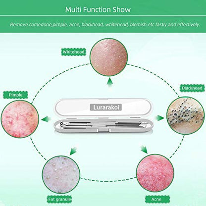 Professional Blackhead Remover Tool Kit - 5-Piece Stainless Steel Comedone Extractor Set for Acne, Pimple, and Blemish Removal