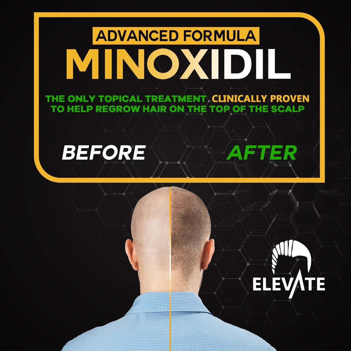Elevate Hair Regrowth Treatment 5% Minoxidil Spray - Extra Strength Formula for Men and Women - 1 Month Supply Avelisse