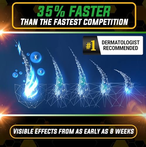Elevate Hair Regrowth Treatment 5% Minoxidil Spray - Extra Strength Formula for Men and Women - 1 Month Supply Avelisse