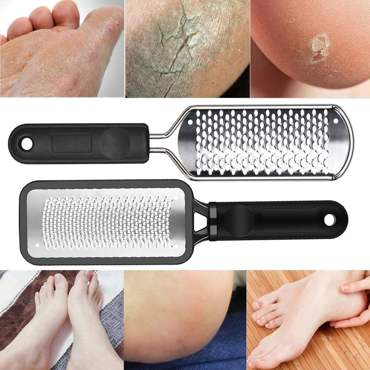 2-Pack Colossal Professional Foot File & Callus Remover | High Grade Stainless Steel Foot Rasp for Wet & Dry Feet | Washable Pedicure Tool for Smooth Heels - görsel 11