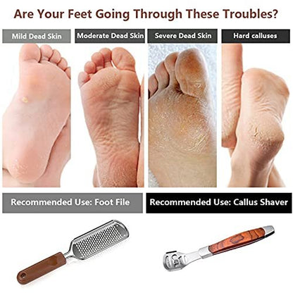 Colossal Foot Rasp & Wood Handle Callus Shaver – 10 Replacement Blades & 1 File Head, Pedicure Foot File Kit, Heel Scraper for Feet
