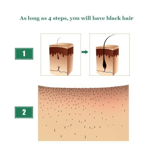 5 Pack Hair Growth Serum – Natural Ginger Essential Oil for Thicker, Stronger Hair | QUNGCO Avelisse