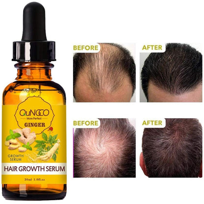 5 Pack Hair Growth Serum – Natural Ginger Essential Oil for Thicker, Stronger Hair | QUNGCO Avelisse