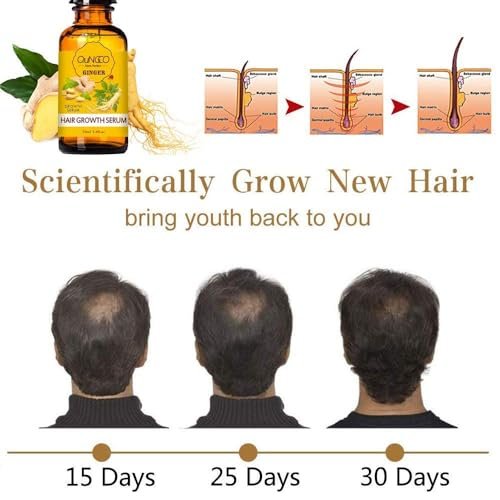 5 Pack Hair Growth Serum – Natural Ginger Essential Oil for Thicker, Stronger Hair | QUNGCO Avelisse