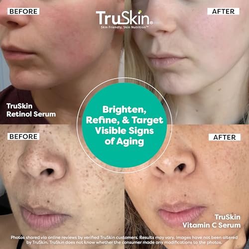 TruSkin Face Serum Duo – Vitamin C & Retinol Serums for AM & PM Anti-Aging Skincare Routine, Brightening & Smoothing Facial Serums, 1 fl oz Each Avelisse