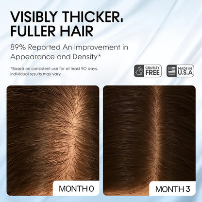 Scalp Delivery AM/PM GHK-CU Peptide Hair Growth Serum | DHT Blocker with Stem Cells, Redensyl, Capixyl, Anagain, Procapil | Multi-Peptide Serum for Hair Density | 2 x 30 mL Avelisse