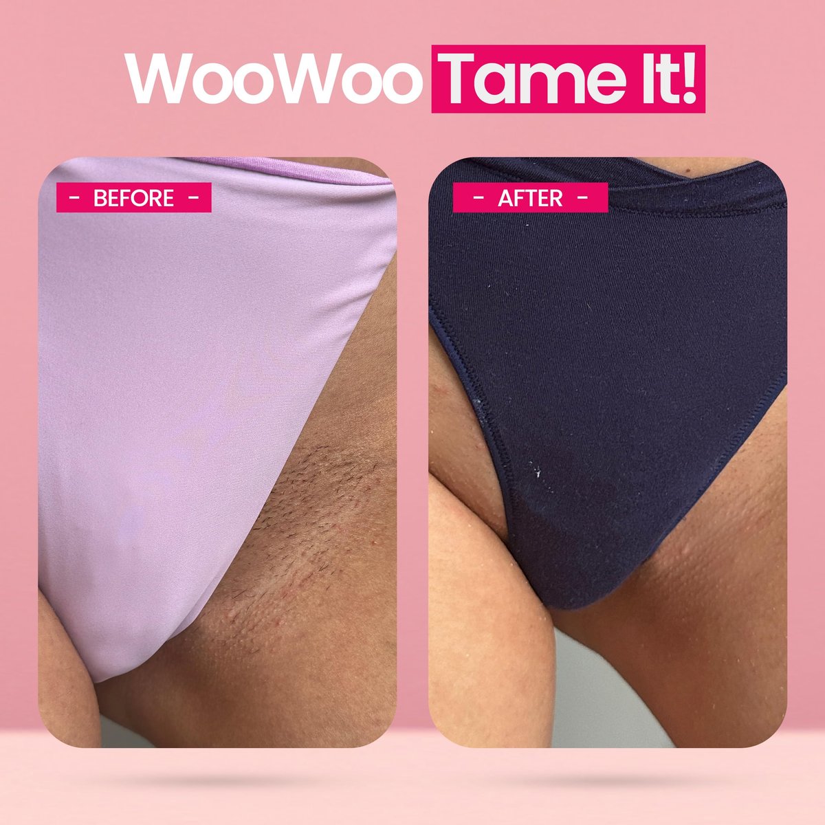 WooWoo Tame It! Natural Intimate Hair Removal Cream - Painless Vegan Depilatory for Sensitive Skin - Bikini, Legs & Bum - 100ml Avelisse