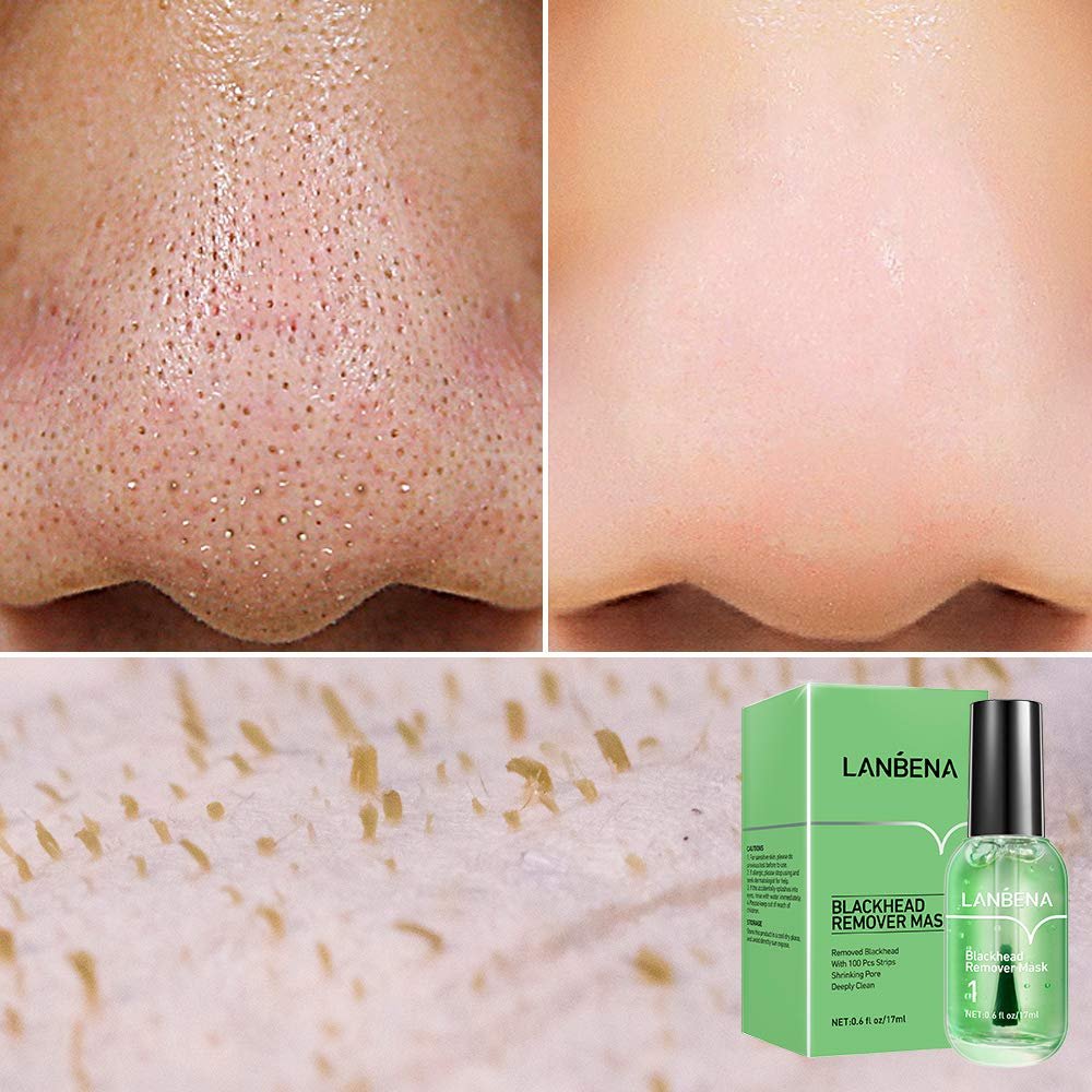 LANBENA Blackhead Remover Mask – 2-in-1 Green Tea Oil Peel Off Mask for Pores, Nose, Chin & Face (100 Sheets) Avelisse