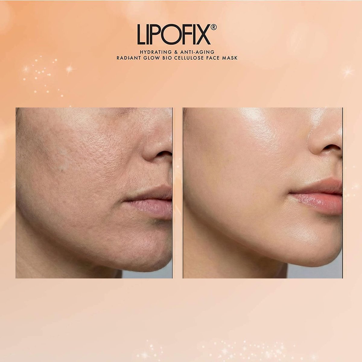 LIPOFIX Bio-Cellulose Anti-Aging Face Mask – Hydrating & Lifting Sheet Mask with 17 Amino Acids, Collagen Boosting, Wrinkle Reducing Spa Treatment for All Skin Types – 5 Pack Avelisse