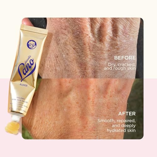 Lanolips Golden Dry Skin Salve - Lanolin Oil Healing Ointment with Vitamin E & Manuka Honey - Body Moisturizer for Dry Skin - Relief for Dry Hands & Cracked Lips - Dermatologist Tested (25g) Avelisse