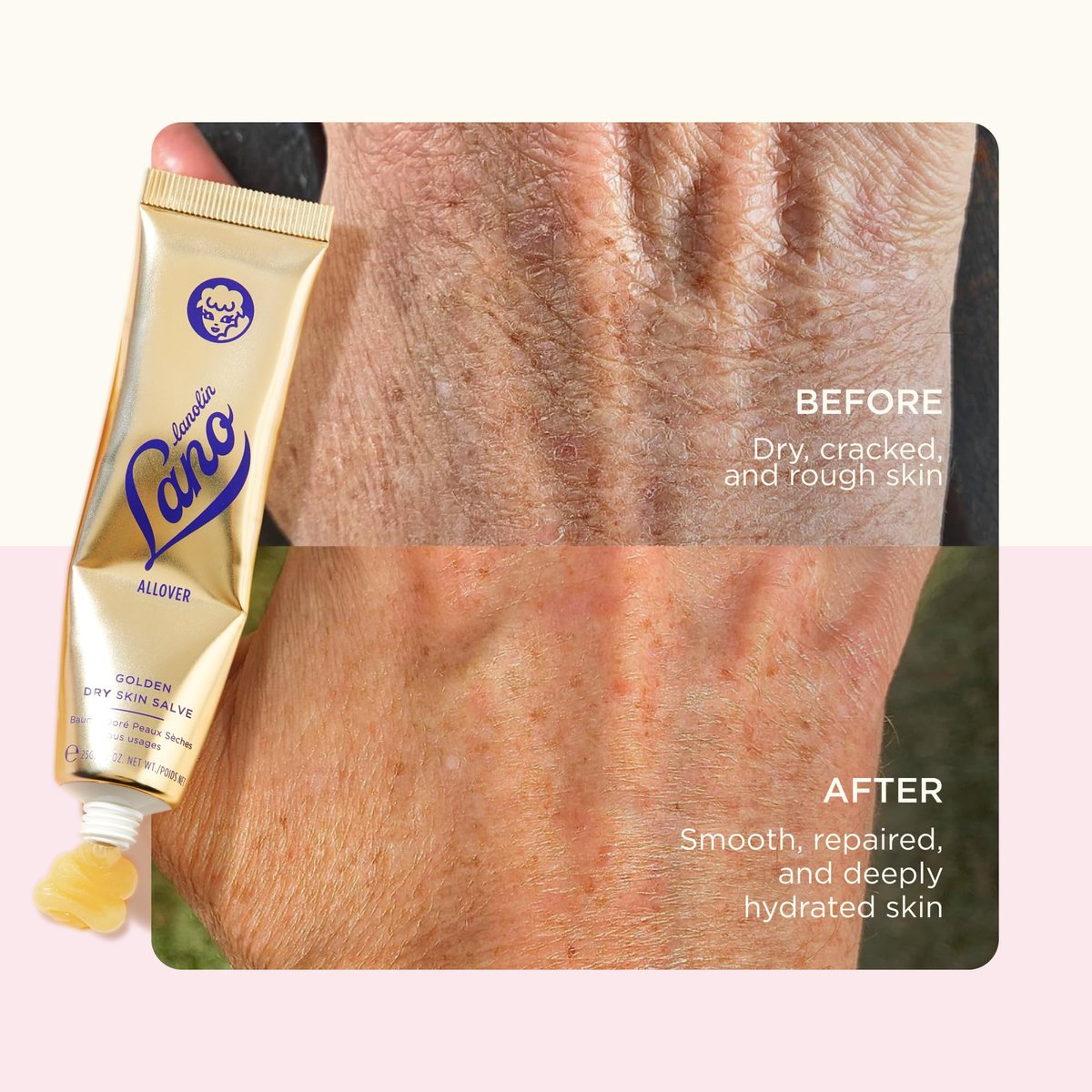 Lanolips Golden Dry Skin Salve - Lanolin Oil Healing Ointment with Vitamin E & Manuka Honey - Body Moisturizer for Dry Skin - Relief for Dry Hands & Cracked Lips - Dermatologist Tested (25g) Avelisse