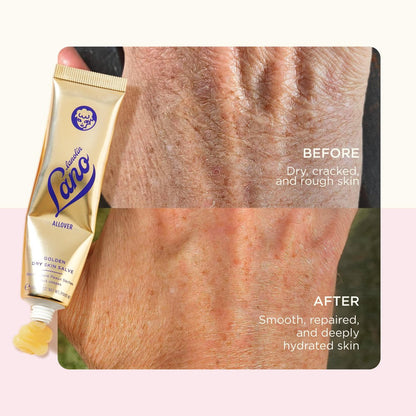 Lanolips Golden Dry Skin Salve - Lanolin Oil Healing Ointment with Vitamin E & Manuka Honey - Body Moisturizer for Dry Skin - Relief for Dry Hands & Cracked Lips - Dermatologist Tested (25g) Avelisse