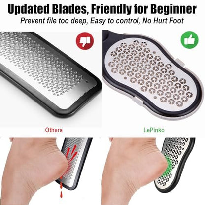 LePinko Foot Scrubber Set - Updated Blades, No Hurt Feet File, Powerful Pedicure Tool for Callus and Dead Skin Removal, Use in Shower or Dry, 2-Pack