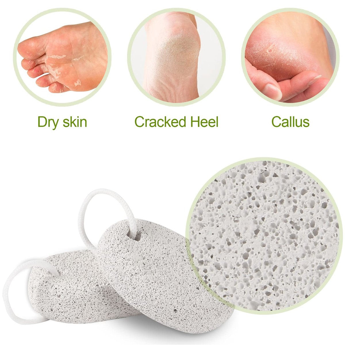 2 Pack Natural Pumice Stone for Feet – Asqraqo Lava Pedicure Tools, Hard Skin & Callus Remover, Exfoliating Foot File for Dead Skin Removal - görsel 7