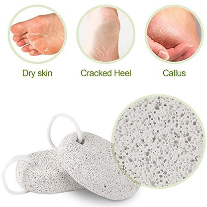 2 Pack Natural Pumice Stone for Feet – Asqraqo Lava Pedicure Tools, Hard Skin & Callus Remover, Exfoliating Foot File for Dead Skin Removal