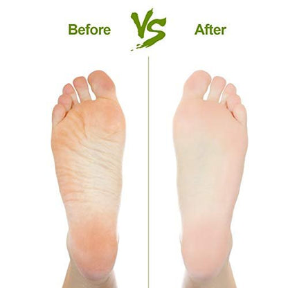 2 Pack Natural Pumice Stone for Feet – Asqraqo Lava Pedicure Tools, Hard Skin & Callus Remover, Exfoliating Foot File for Dead Skin Removal