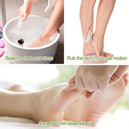 2 Pack Natural Pumice Stone for Feet – Asqraqo Lava Pedicure Tools, Hard Skin & Callus Remover, Exfoliating Foot File for Dead Skin Removal