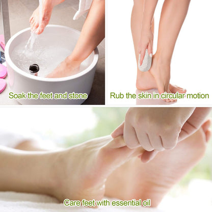 2 Pack Natural Pumice Stone for Feet – Asqraqo Lava Pedicure Tools, Hard Skin & Callus Remover, Exfoliating Foot File for Dead Skin Removal