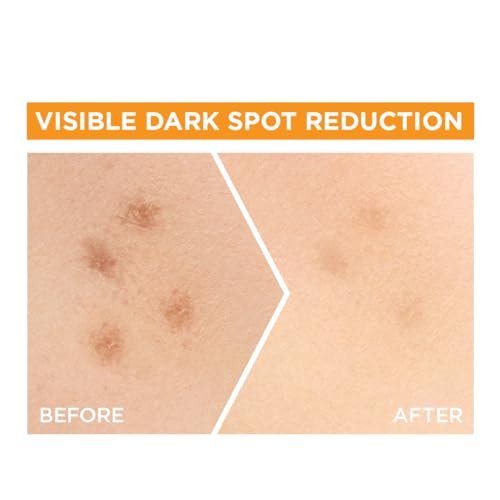 Garnier Bright Complete Vitamin C Booster Face Serum, 30ml – Brightening & Dark Spot Corrector - görsel 10