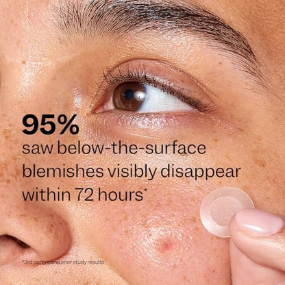Peach Slices Deep Blemish Microdarts - Early Stage Pimple Patches with Salicylic Acid, Niacinamide, Hyaluronic Acid, Tea Tree Oil & Cica - Vegan & Cruelty Free Korean Skin Care (9 ct)