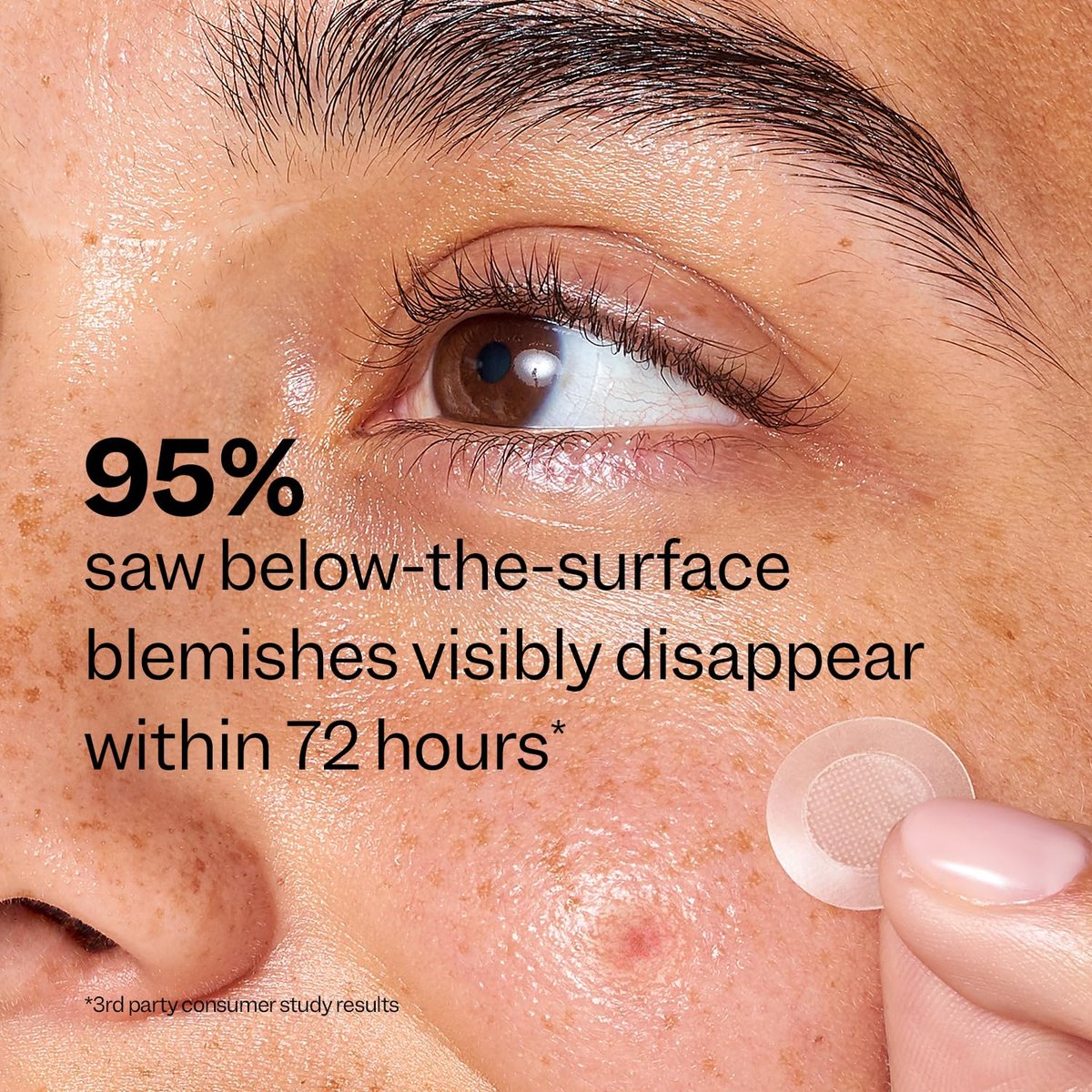 Peach Slices Deep Blemish Microdarts - Early Stage Pimple Patches with Salicylic Acid, Niacinamide, Hyaluronic Acid, Tea Tree Oil & Cica - Vegan & Cruelty Free Korean Skin Care (9 ct) - görsel 11